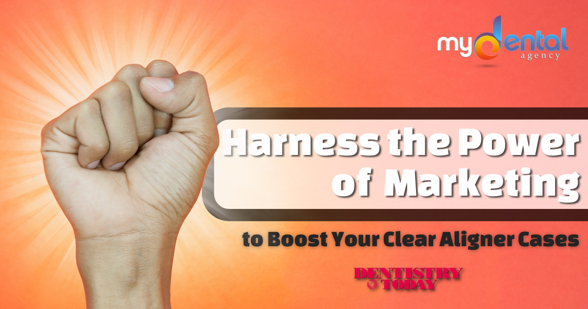 Clear Aligners: Harnessing the Power of Comprehensive Marketing to Boost Cases at Your Practice
