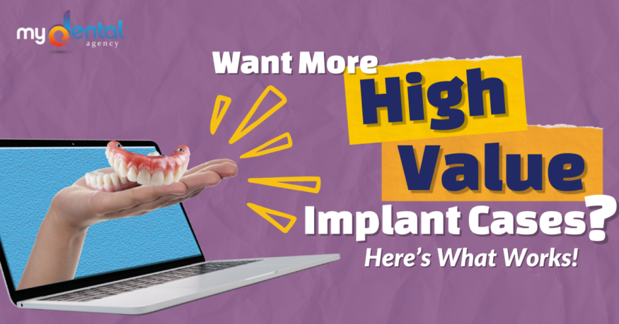 Want More High-Value Implant Cases?